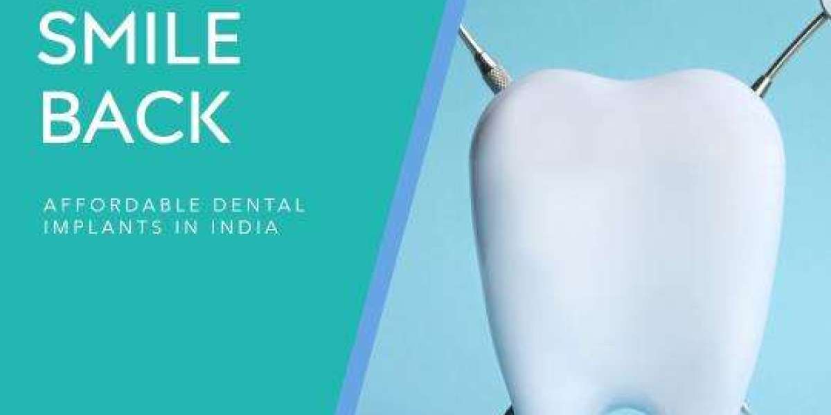 Best Dental Implant treatment in Kerala