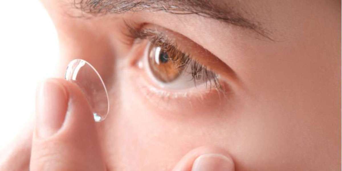 Contact Lenses Market Analysis By Industry Share, Merger, Acquisition, Size Estimation, Statistics, Overview, and Foreca
