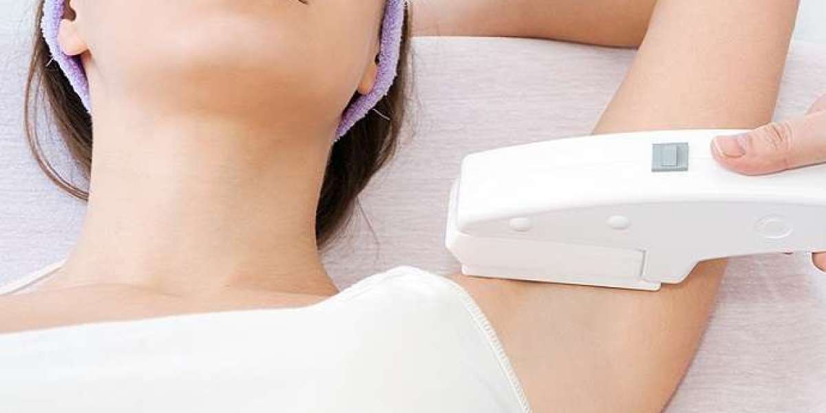 Unveiling the Beauty Revolution: The Aesculpir's Laser Hair Removal Treatment in Delhi