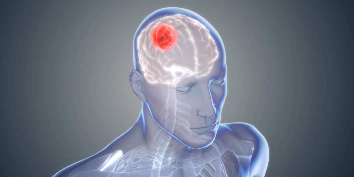 Early Warning Signs And Symptoms Of Brain Cancer
