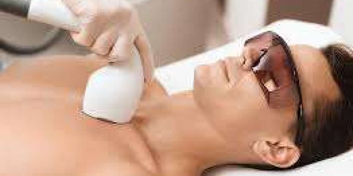 Laser Hair Removal in Noida: A Modern Solution for Smooth Skin