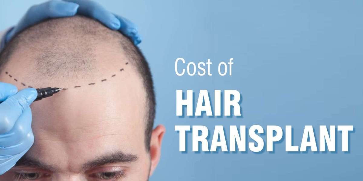 Tips To Follow For a Quicker Recovery After Hair Transplant