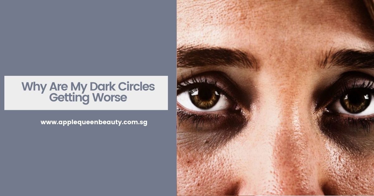 Dark Eye Circles - Why Are My Dark Circles Getting Worse