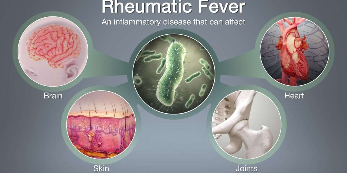 Early Diagnosis Key: The Rheumatic Fever Market Across Regions