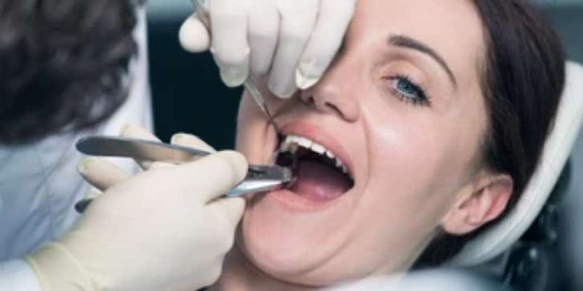 Say Goodbye to Dental Woes: Where to Find Top-Notch Dental Crowns Near Me