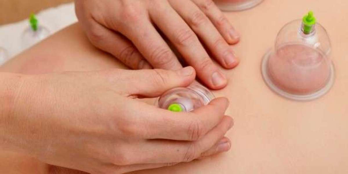 Acupuncture for Weight Loss: A Holistic Path to Wellness