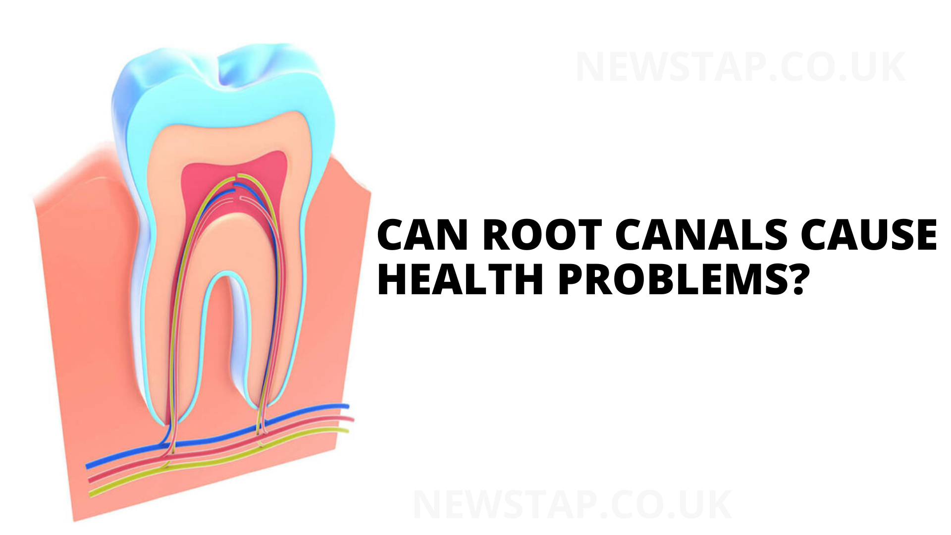 Can root canals cause health problems? doctor say yes? - newstap.co.uk