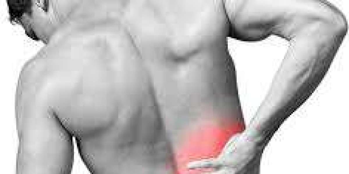 Top 10 Exercises for Alleviating Chronic Back Pain