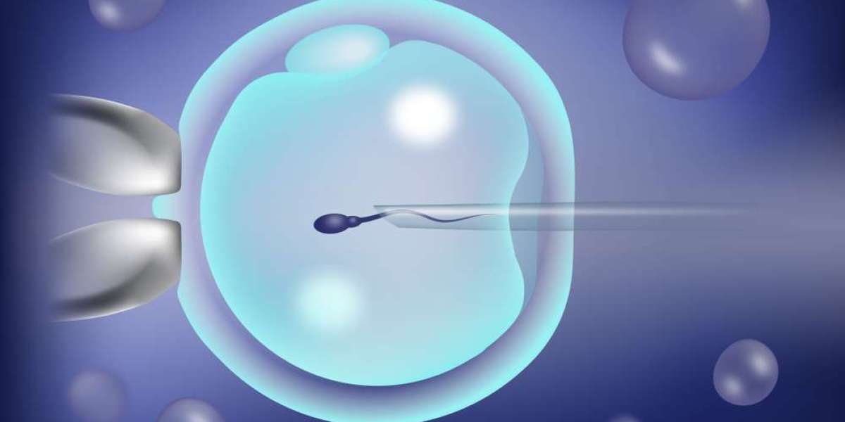 Experience Excellence: ICSI Treatment in Delhi at Prime IVF
