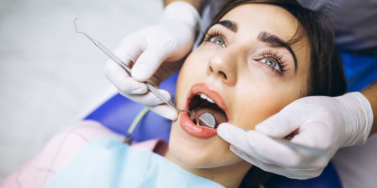 Transform Your Smile with Dental Implants Alexandria