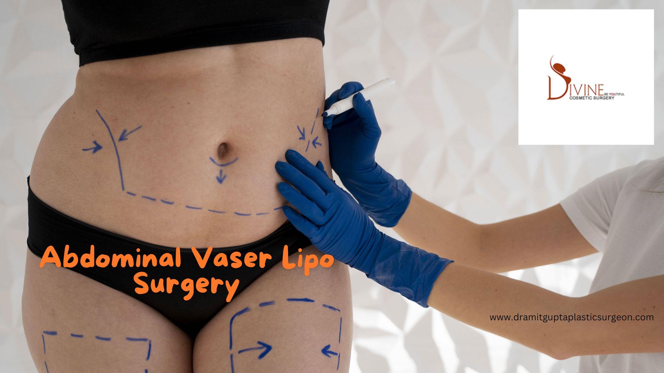 Best Abdominal VASER Liposuction in Delhi, India