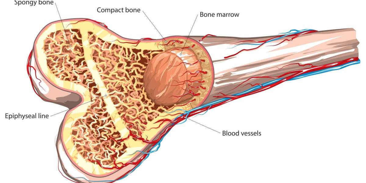 Hope on the Horizon: The Future of Bone Marrow Transplants