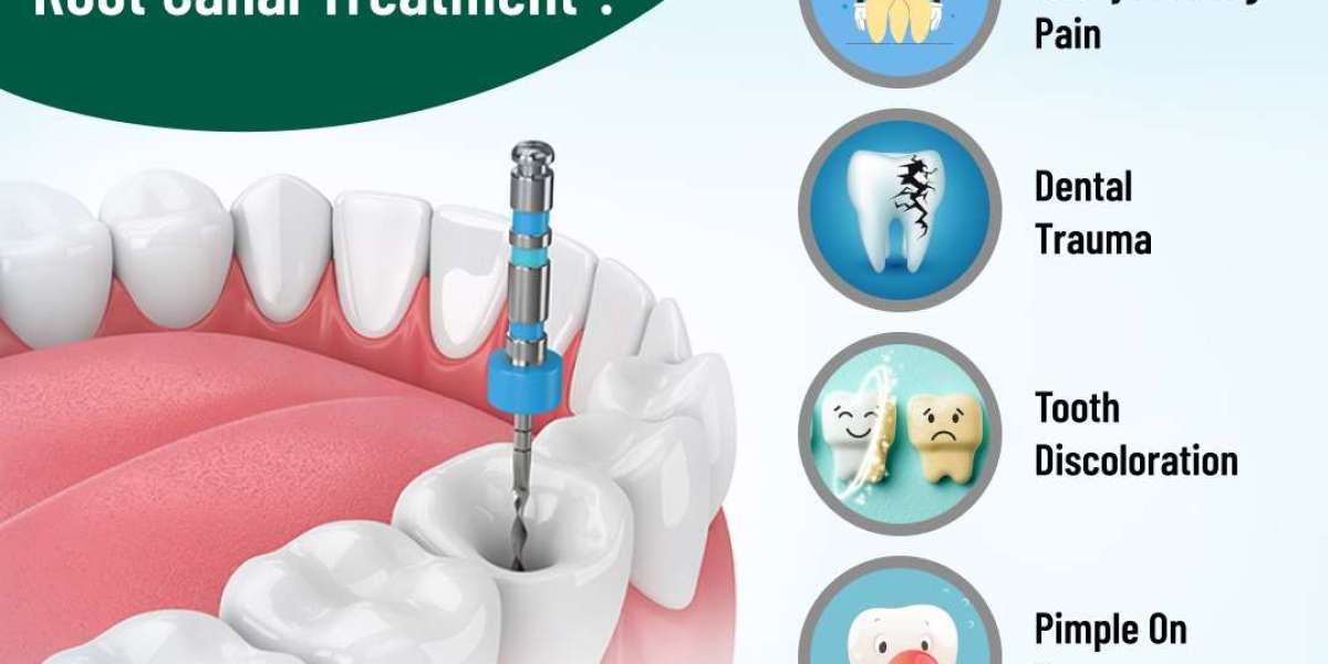 Say Goodbye to Dental Anxiety with Painless Root Canal Treatment in Bangalore