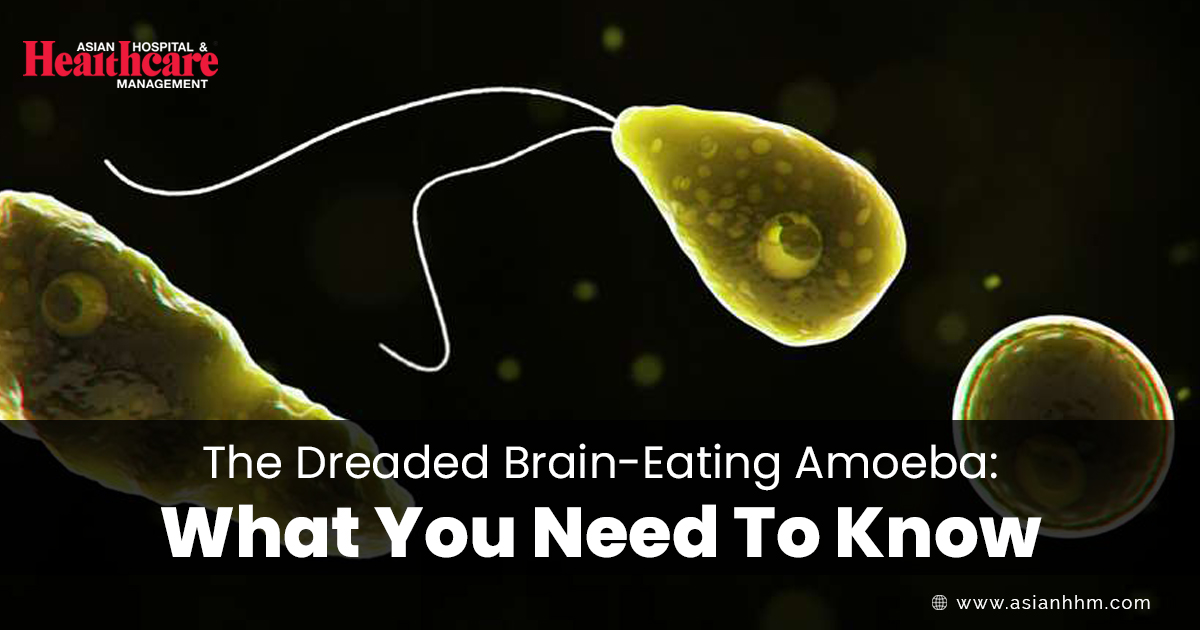 The Dreaded Brain-Eating Amoeba: What You Need To Know