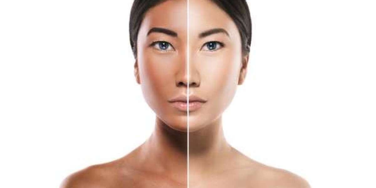 Skin Whitening and Brightening: Tips from Dubai Dermatologists