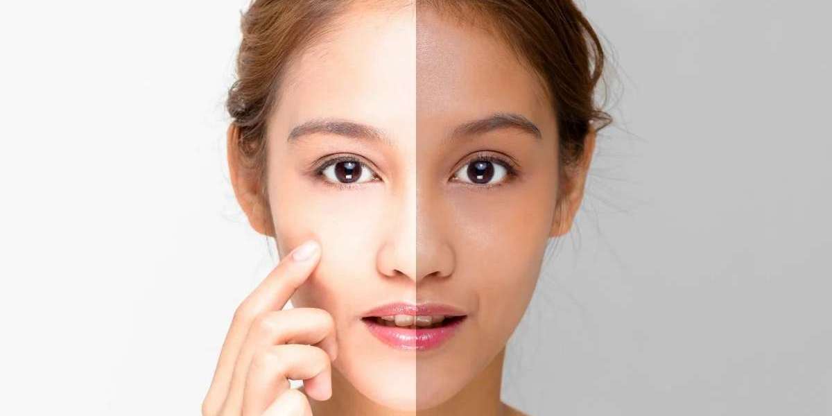 Dubai's Guide to Safe Skin Brightening for Sensitive Skin