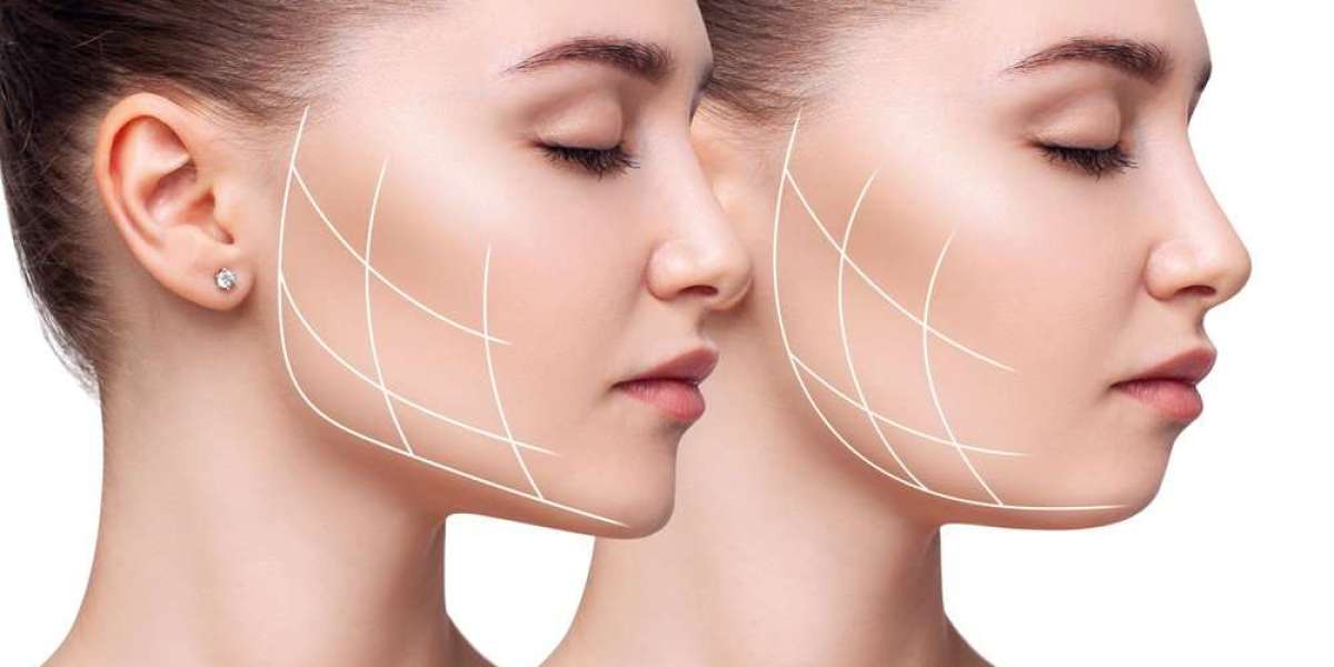 Facial Rejuvenation Explained: Procedures, Costs, and Results