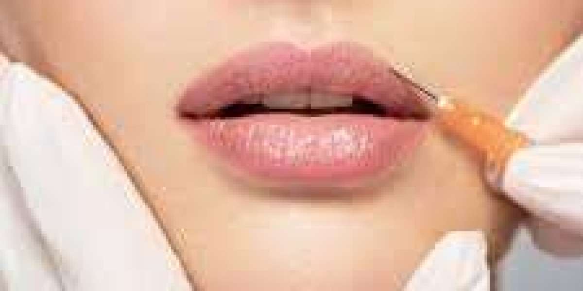 Dubai’s Elite Choice: Russian Lip Fillers for Perfect Lips