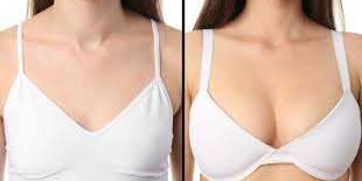 Combining Breast Surgery with Other Cosmetic Procedures in Dubai