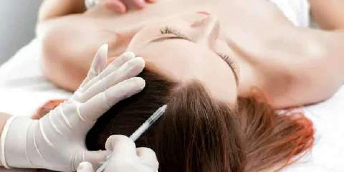 A Complete Guide to Plasma Injections for Hair in Abu Dhabi