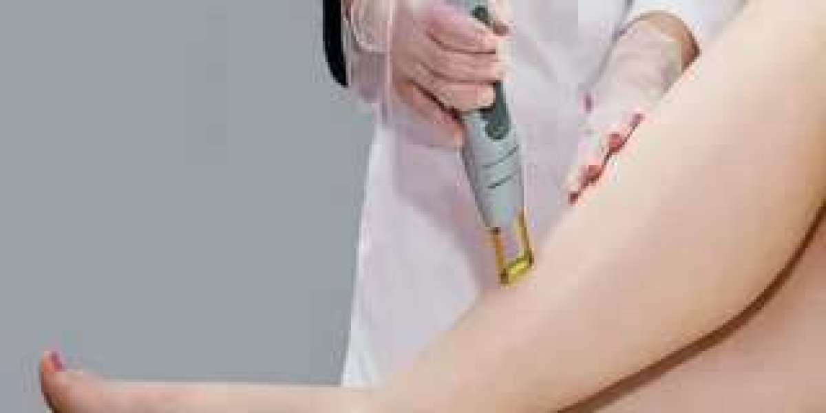 Say Goodbye to Leg Hair with Laser Removal in Dubai