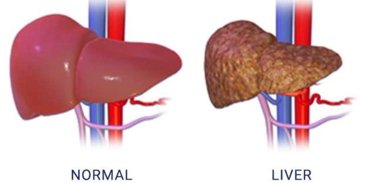 The Comprehensive Guide to Liver Health with Dr. Piyush Ranjan – Delhi’s Leading Liver Specialist Doctor