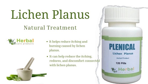 Natural Supplements for Lichen Planus: Say Goodbye to Irritated Skin - Latest Talks