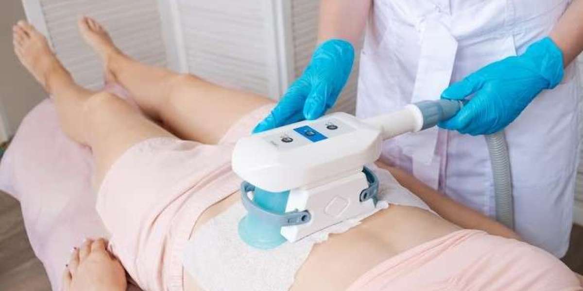 Body Contouring Made Easy: The Benefits of CoolSculpting in Singapore