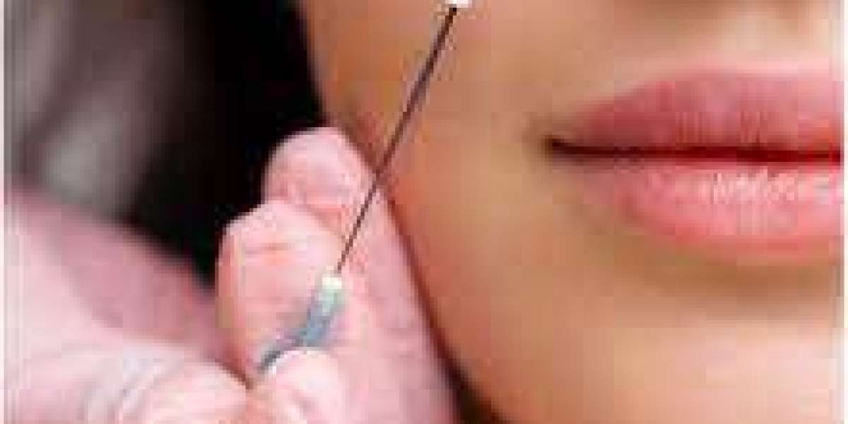 "Jawline Fillers: How to Choose the Right Provider"