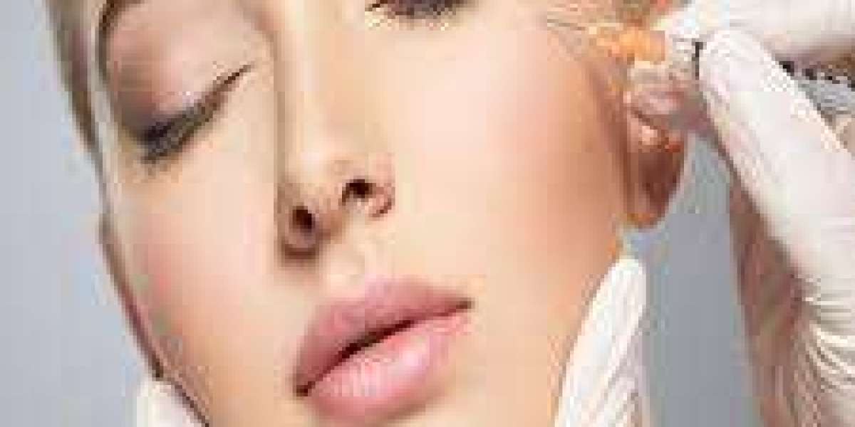 Volift vs. Voluma: Which Juvederm Filler is Best for You?