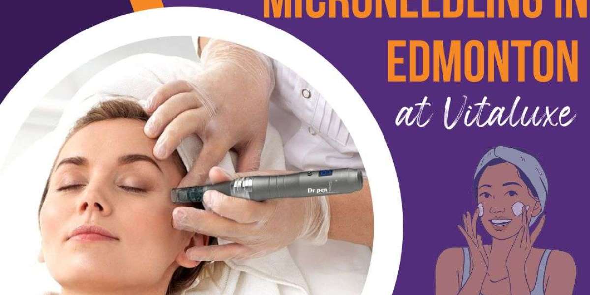 The Benefits of Microneedling: Rejuvenate Your Skin with Vitaluxe