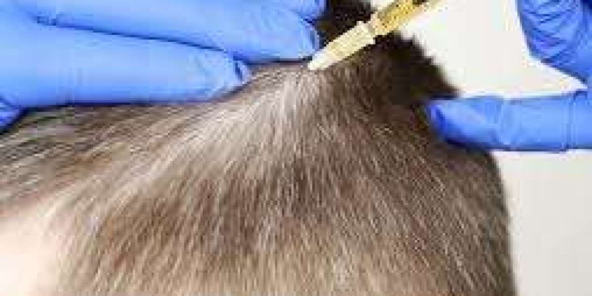 From Hair Loss to Hair Growth: Dubai’s PRP Injection Therapy