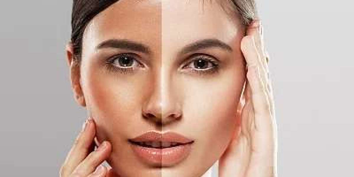 From Dull to Radiant: The Best Skin Whitening Solutions in Dubai